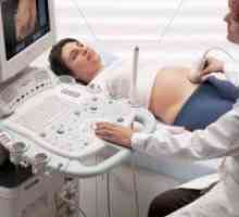 33 Недели на бременост: ултразвук
