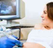 Што може да се види на ултразвук во 32 недела од бременоста?