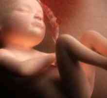 Fetometry фетусот 32 недели
