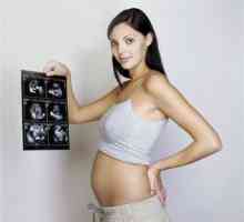 Сликите на ултразвук 20 недели на бременост
