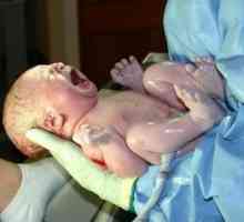 Хипоксија во новороденче - опасна состојба