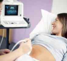 Колку често може да направи ултразвук во бременоста