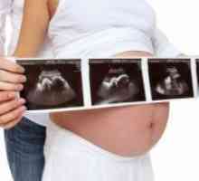 Олигохидрамнион за време на бременост: 34 недели