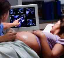 Третиот ултразвук во бременоста