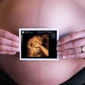 Што е 3D ултразвук во бременоста