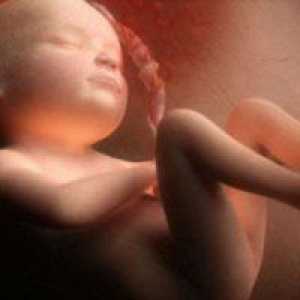 Fetometry фетусот 32 недели
