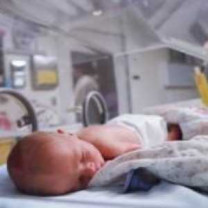 Хипоксија кај новороденчиња