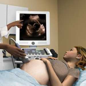 Првиот ултразвучен преглед во бременоста