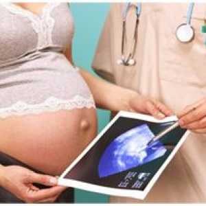 Рок на достасување од плацентата за време на бременоста